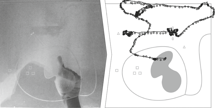 Determining the bias and variance of a deterministic finger-tracking algorithm